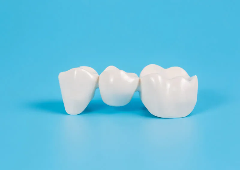 Dental crowns and a bridge alongside an implant post